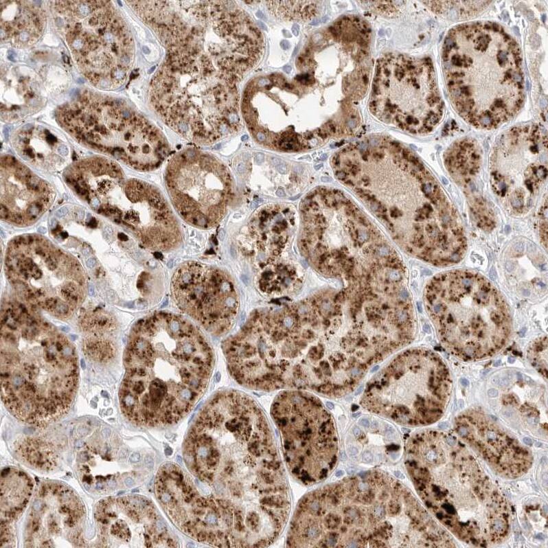 gamma-glutamyl hydrolase Antibody - BSA Free Immunohistochemistry: gamma-glutamyl hydrolase Antibody - BSA Free [NBP1-90927]