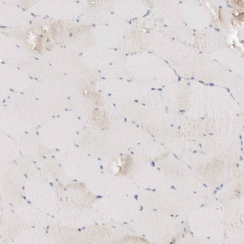 gamma-glutamyl hydrolase Antibody - BSA Free Immunohistochemistry: gamma-glutamyl hydrolase Antibody - BSA Free [NBP1-90927]