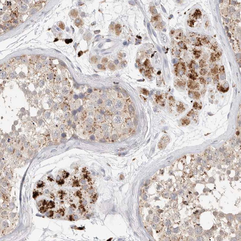 gamma-glutamyl hydrolase Antibody - BSA Free Immunohistochemistry: gamma-glutamyl hydrolase Antibody - BSA Free [NBP1-90927]