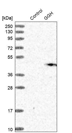 gamma-glutamyl hydrolase Antibody - BSA Free Western Blot: gamma-glutamyl hydrolase Antibody - BSA Free [NBP1-90927]