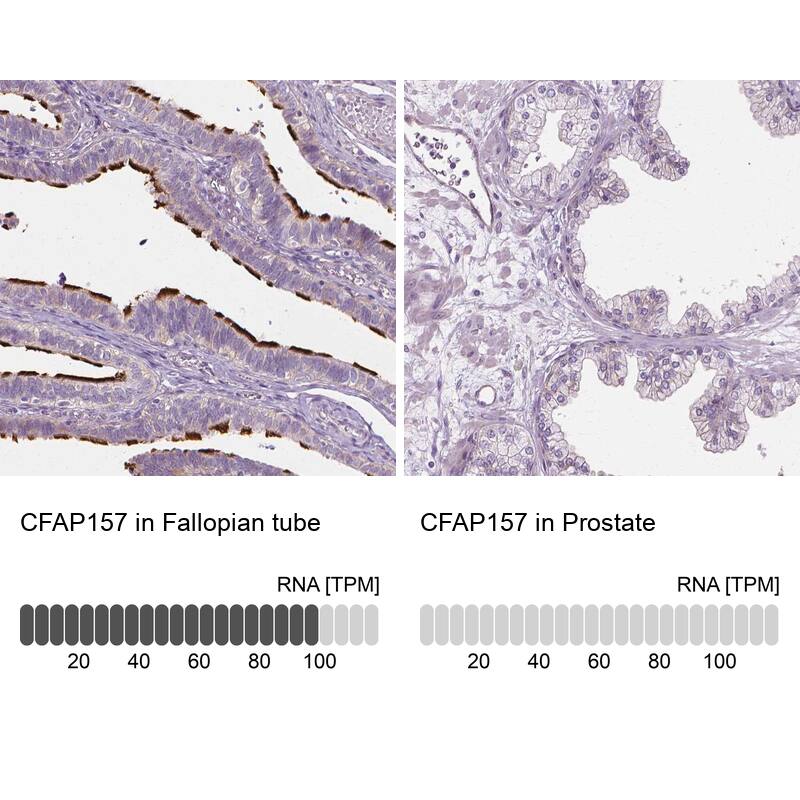 CFAP157 Antibody - BSA Free Immunohistochemistry: CFAP157 Antibody - BSA Free [NBP1-90934]