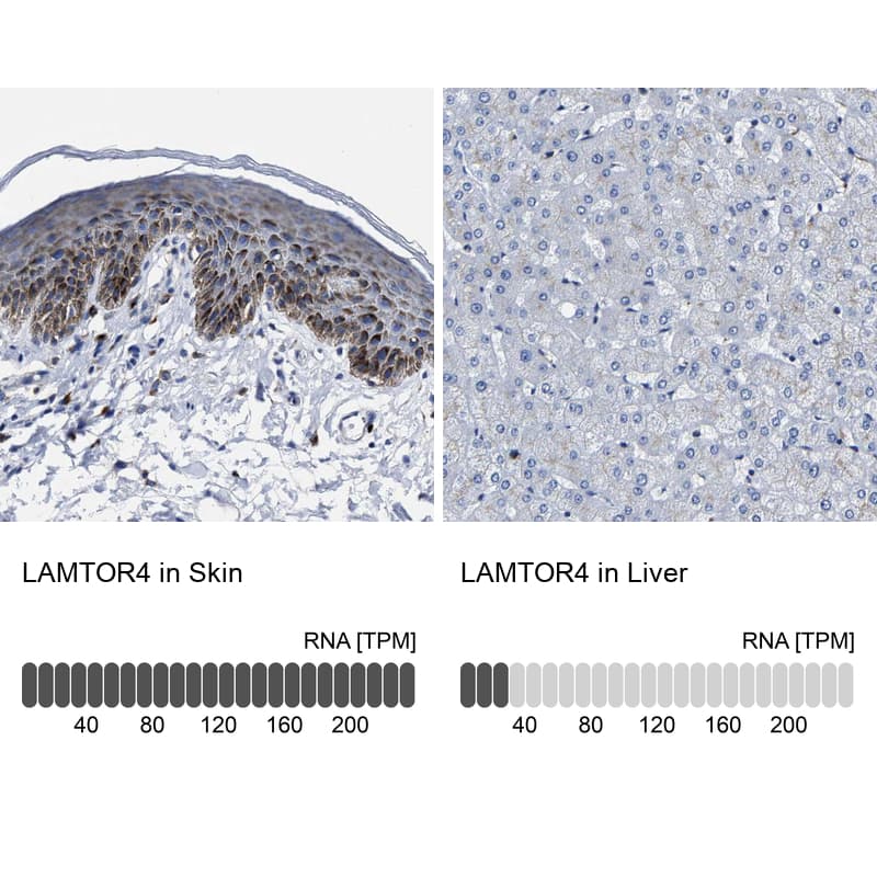 LAMTOR4 Antibody - BSA Free Immunohistochemistry: LAMTOR4 Antibody - BSA Free [NBP1-90936]