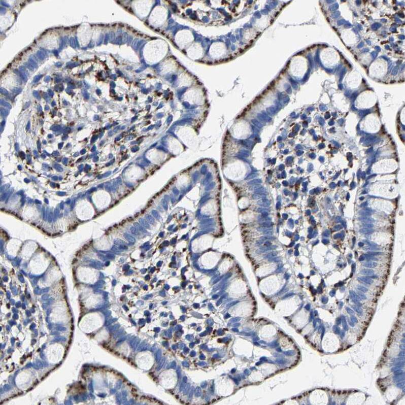 LAMTOR4 Antibody - BSA Free Immunohistochemistry: LAMTOR4 Antibody - BSA Free [NBP1-90936]