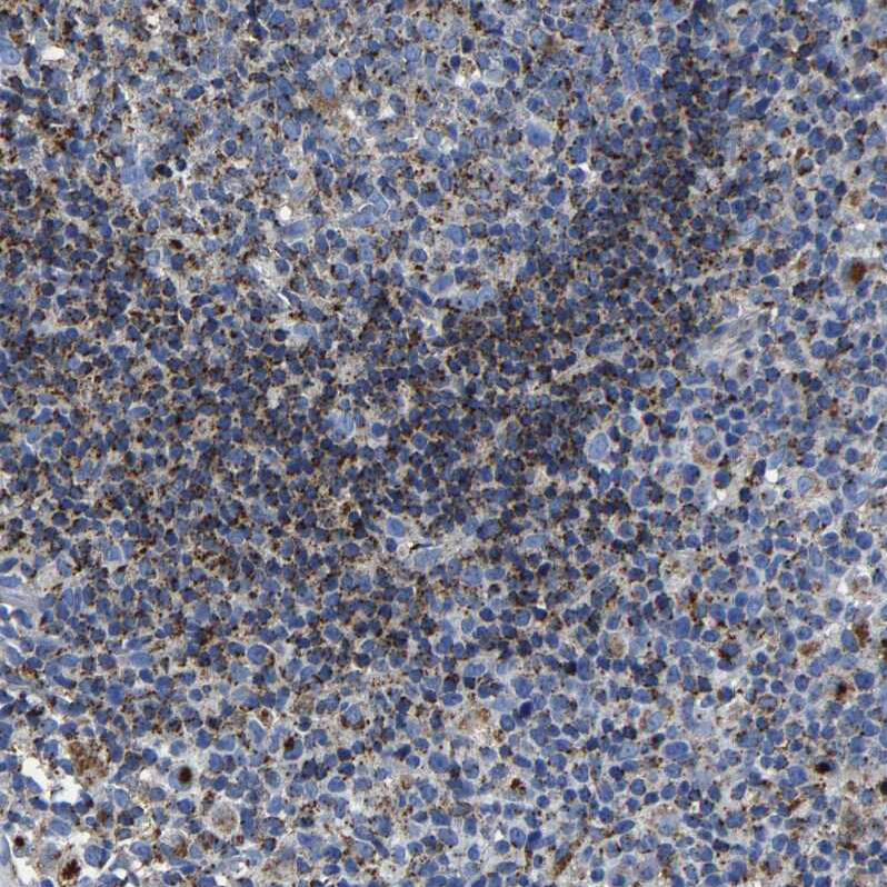 LAMTOR4 Antibody - BSA Free Immunohistochemistry: LAMTOR4 Antibody - BSA Free [NBP1-90936]