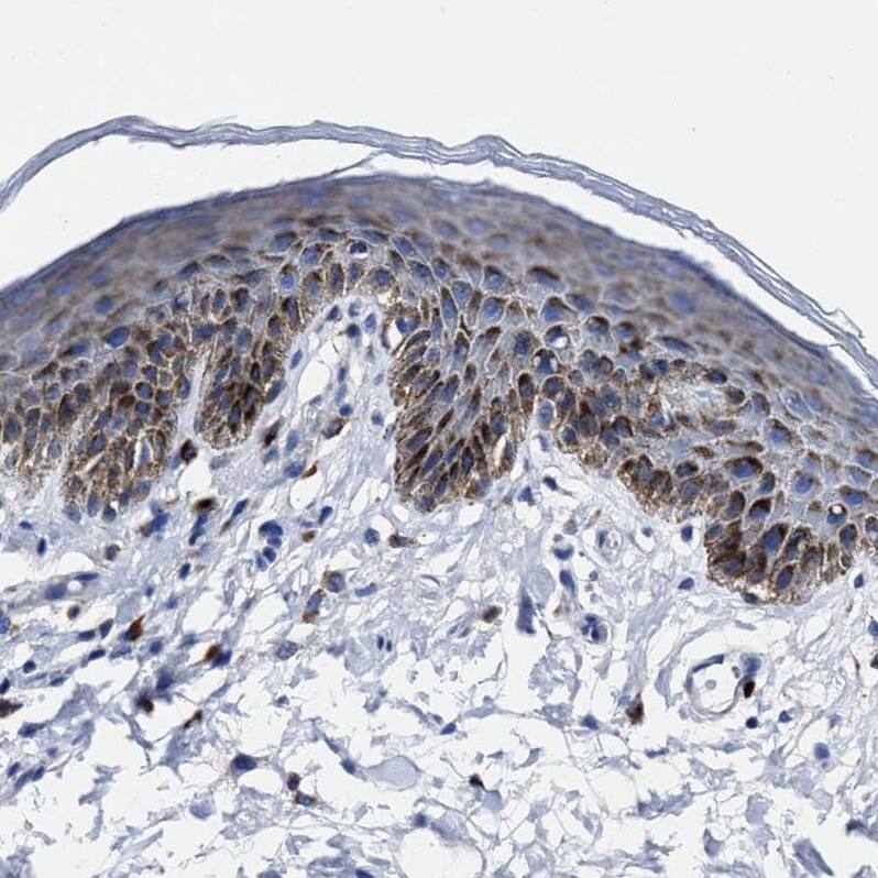 LAMTOR4 Antibody - BSA Free Immunohistochemistry: LAMTOR4 Antibody - BSA Free [NBP1-90936]