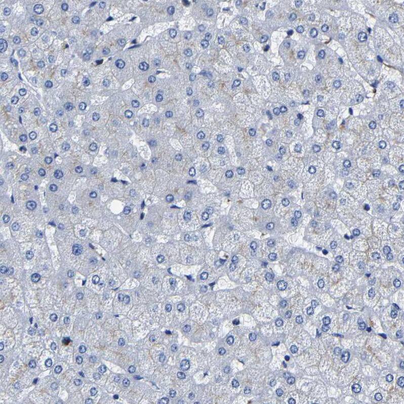 LAMTOR4 Antibody - BSA Free Immunohistochemistry: LAMTOR4 Antibody - BSA Free [NBP1-90936]