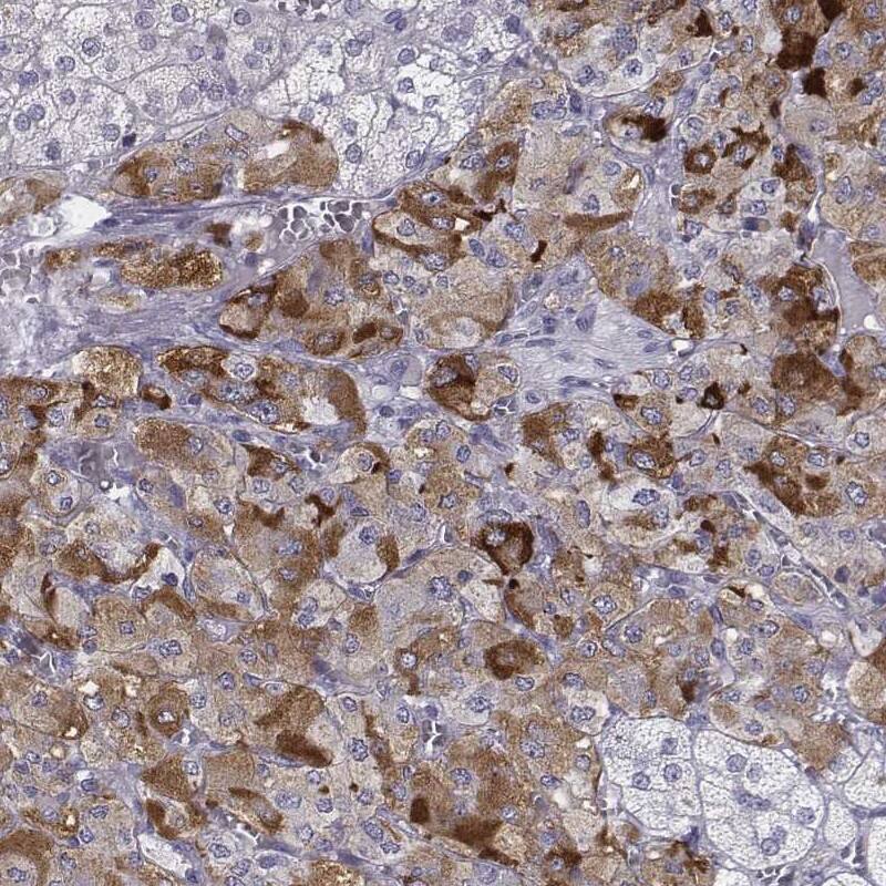 Met-enkephalin Antibody - BSA Free Immunohistochemistry: Met-enkephalin Antibody - BSA Free [NBP1-90944]
