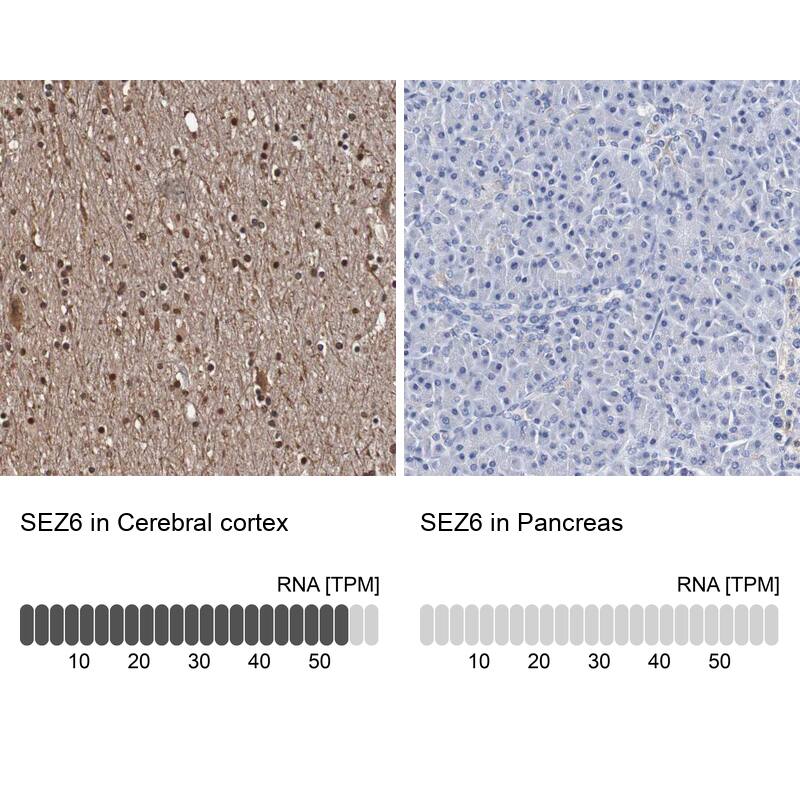 SEZ6/BSRP-C Antibody - BSA Free Immunohistochemistry: SEZ6/BSRP-C Antibody - BSA Free [NBP1-90945]