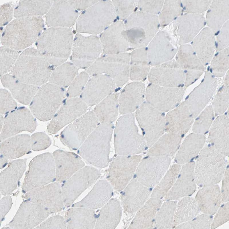 MLK4 Antibody - BSA Free Immunohistochemistry: MLK4 Antibody - BSA Free [NBP1-90950]