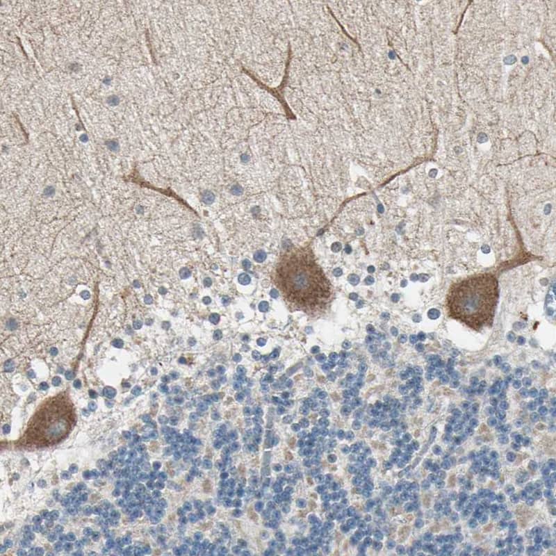 MLK4 Antibody - BSA Free Immunohistochemistry: MLK4 Antibody - BSA Free [NBP1-90950]