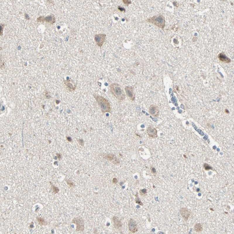 MLK4 Antibody - BSA Free Immunohistochemistry: MLK4 Antibody - BSA Free [NBP1-90950]