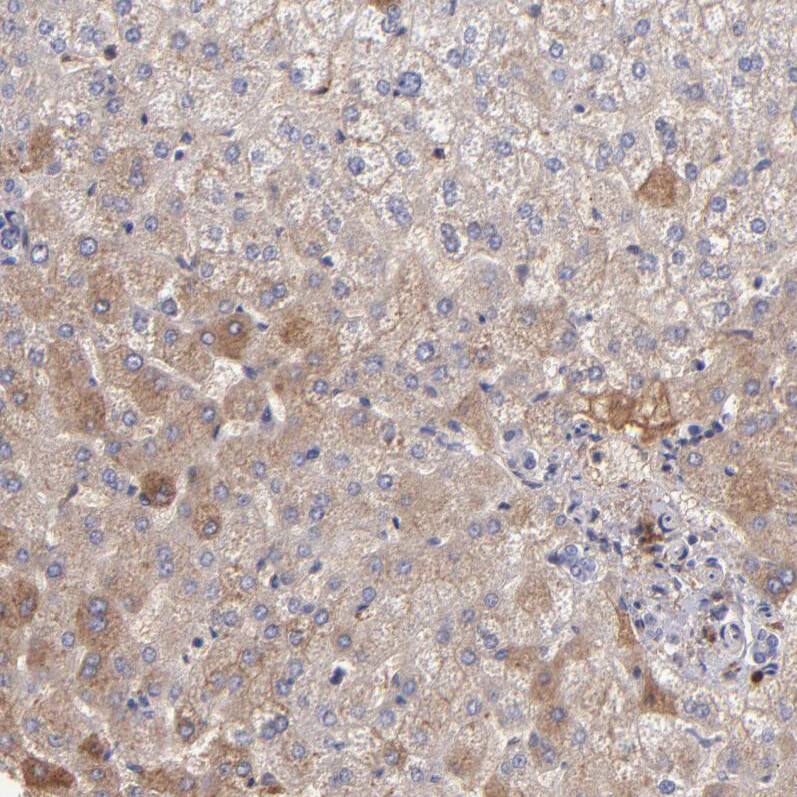 Fibrinogen beta chain Antibody - BSA Free Immunohistochemistry: Fibrinogen beta chain Antibody - BSA Free [NBP1-90956]