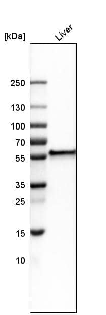 Fibrinogen beta chain Antibody - BSA Free Western Blot: Fibrinogen beta chain Antibody - BSA Free [NBP1-90956]