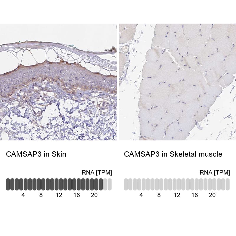 CAMSAP3 Antibody - BSA Free Immunohistochemistry: CAMSAP3 Antibody - BSA Free [NBP1-90961]