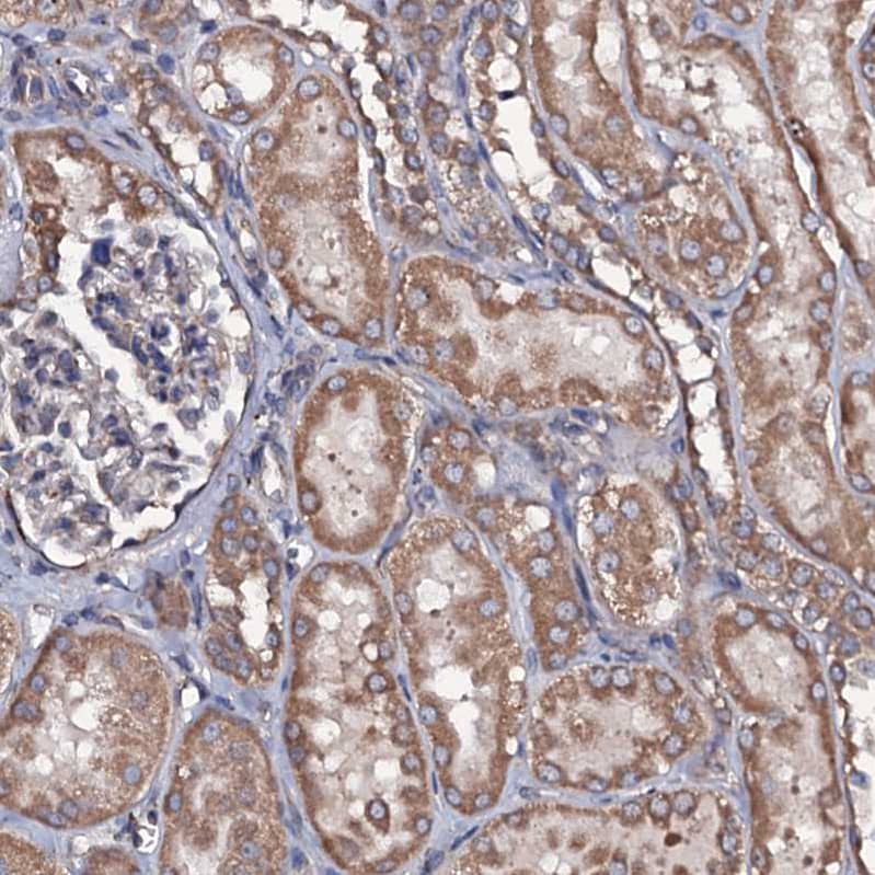 RAB12 Antibody - BSA Free Immunohistochemistry: RAB12 Antibody - BSA Free [NBP1-90976]