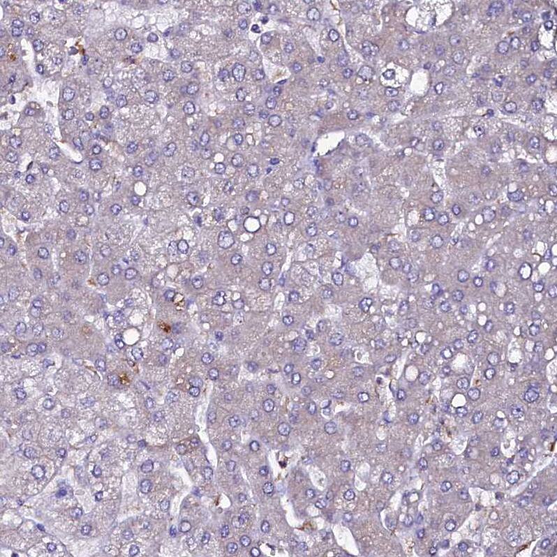SELT Antibody - BSA Free Immunohistochemistry: SELT Antibody - BSA Free [NBP1-90979]