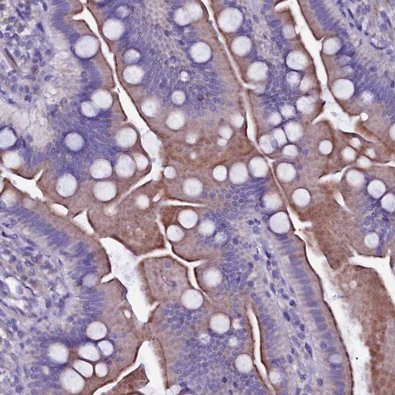 SELT Antibody - BSA Free Immunohistochemistry: SELT Antibody - BSA Free [NBP1-90979]