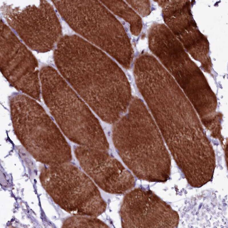 SELT Antibody - BSA Free Immunohistochemistry: SELT Antibody - BSA Free [NBP1-90979]