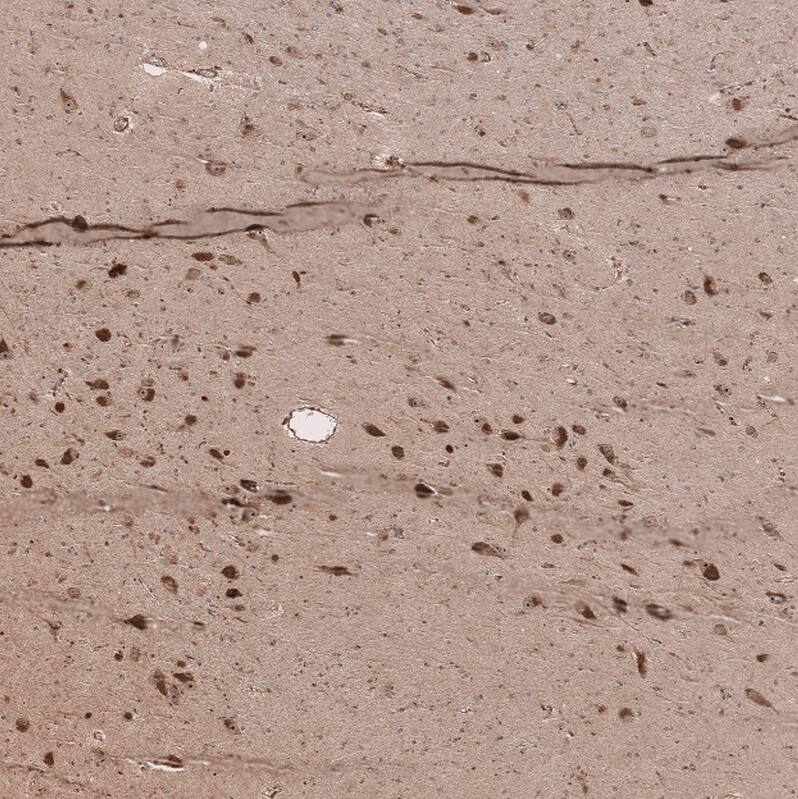 SELT Antibody - BSA Free Immunohistochemistry: SELT Antibody - BSA Free [NBP1-90979]