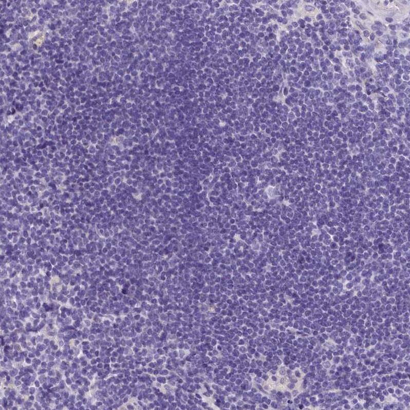 INSC Antibody - BSA Free Immunohistochemistry: INSC Antibody - BSA Free [NBP1-90980]