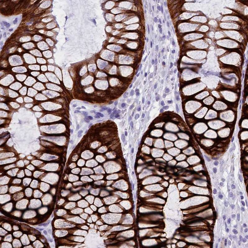 INSC Antibody - BSA Free Immunohistochemistry: INSC Antibody - BSA Free [NBP1-90980]