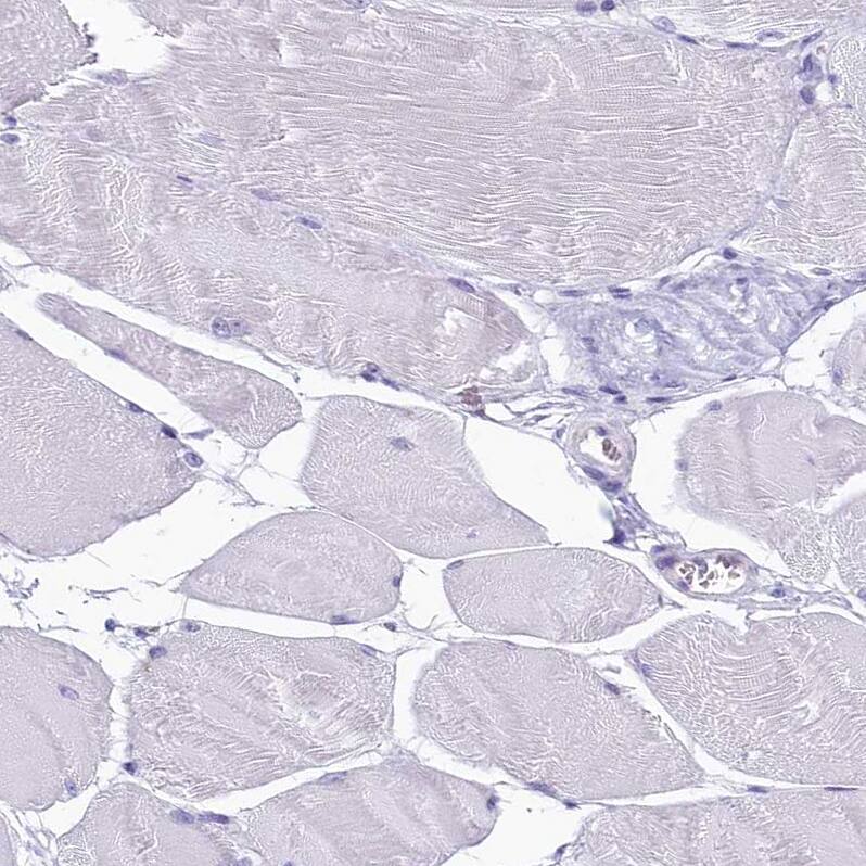 INSC Antibody - BSA Free Immunohistochemistry: INSC Antibody - BSA Free [NBP1-90980]