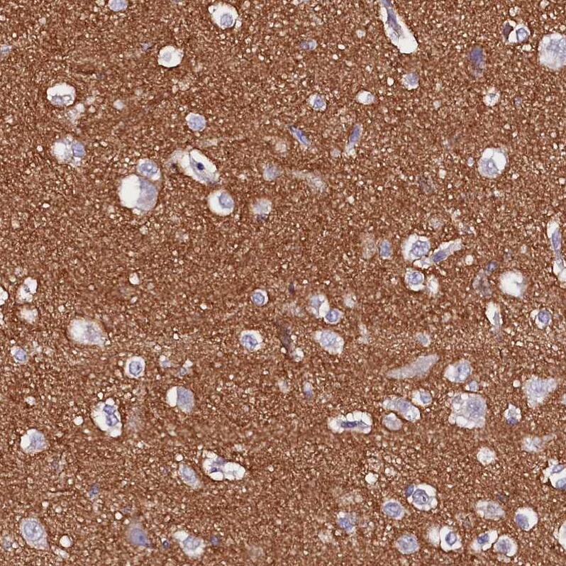FAM155A Antibody - BSA Free Immunohistochemistry: FAM155A Antibody - BSA Free [NBP1-90982]