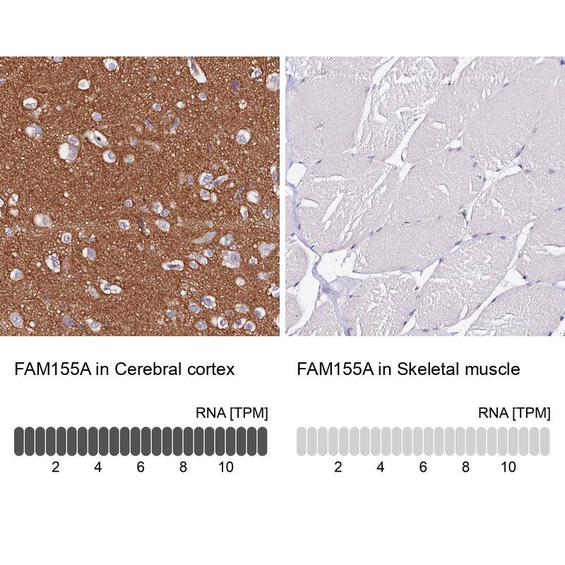 FAM155A Antibody - BSA Free Immunohistochemistry: FAM155A Antibody - BSA Free [NBP1-90982]