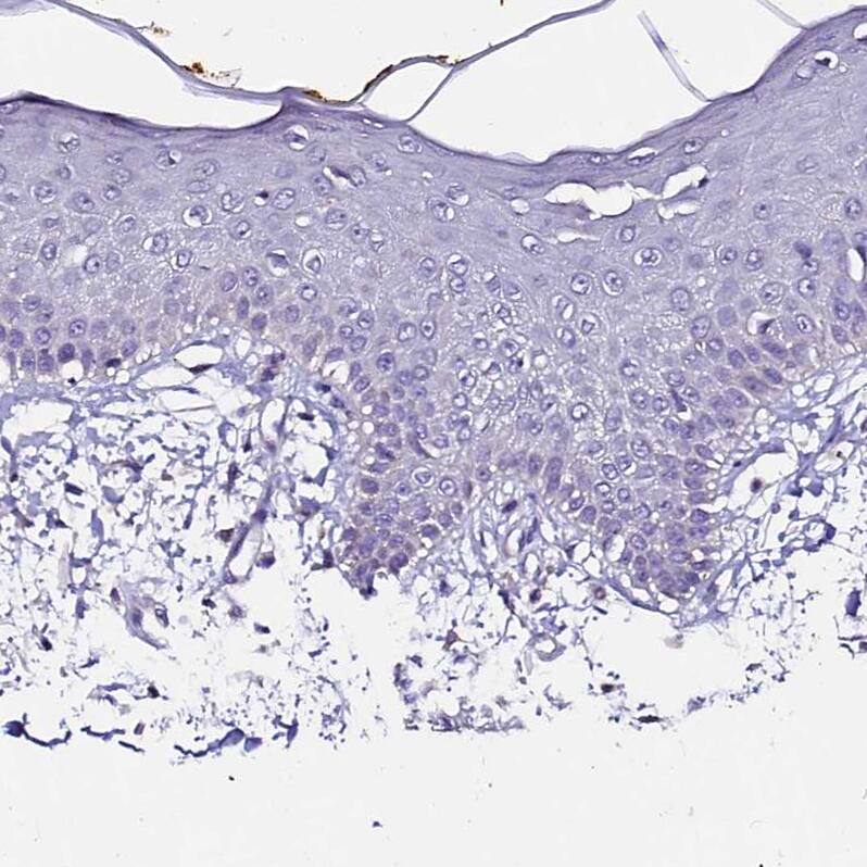 FAM155A Antibody - BSA Free Immunohistochemistry: FAM155A Antibody - BSA Free [NBP1-90982]