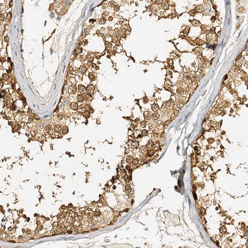 METTL12 Antibody - BSA Free Immunohistochemistry-Paraffin: METTL12 Antibody [NBP1-90987]