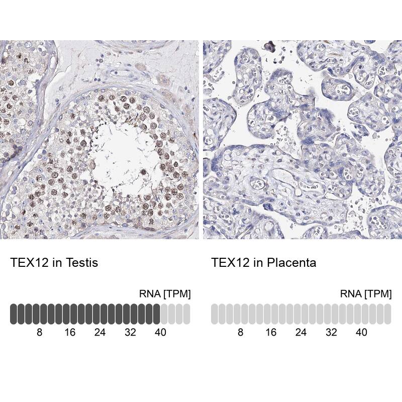 TEX12 Antibody - BSA Free Immunohistochemistry: TEX12 Antibody - BSA Free [NBP1-90989]