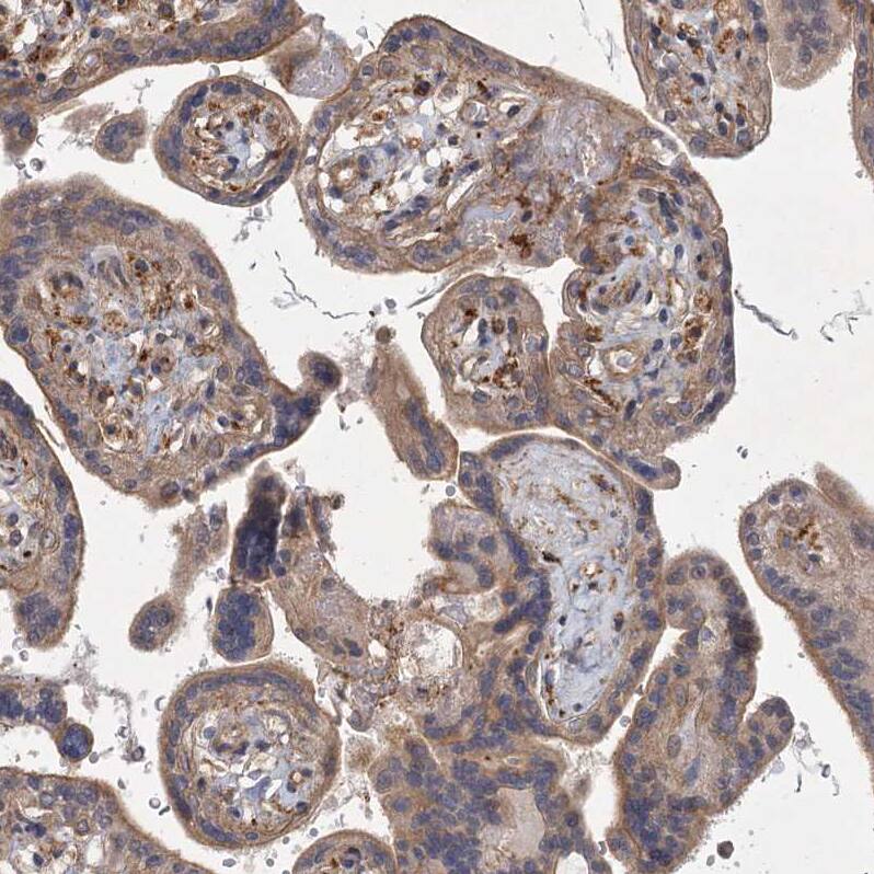 MEPE/OF45 Antibody - BSA Free Immunohistochemistry: MEPE/OF45 Antibody - BSA Free [NBP1-90993]