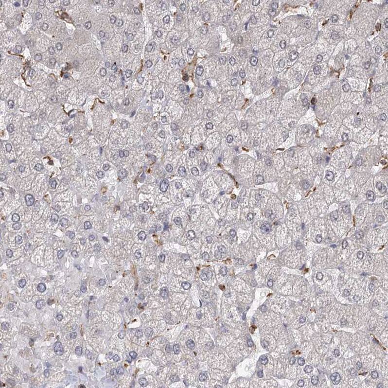 MEPE/OF45 Antibody - BSA Free Immunohistochemistry: MEPE/OF45 Antibody - BSA Free [NBP1-90993]