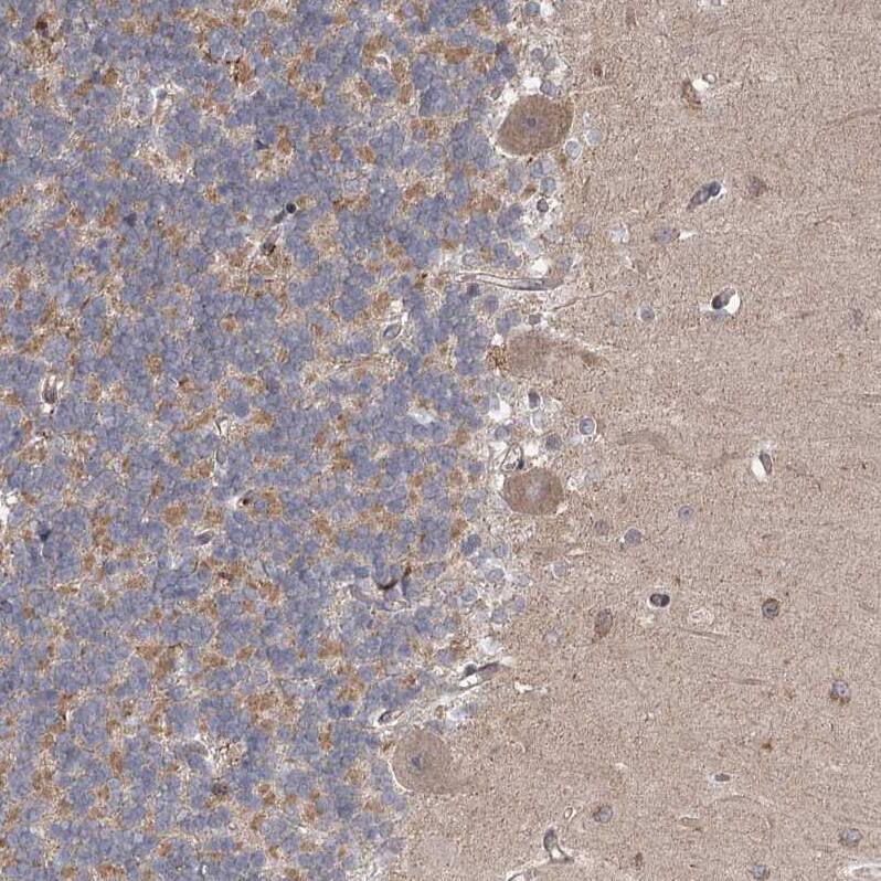 MEPE/OF45 Antibody - BSA Free Immunohistochemistry: MEPE/OF45 Antibody - BSA Free [NBP1-90993]