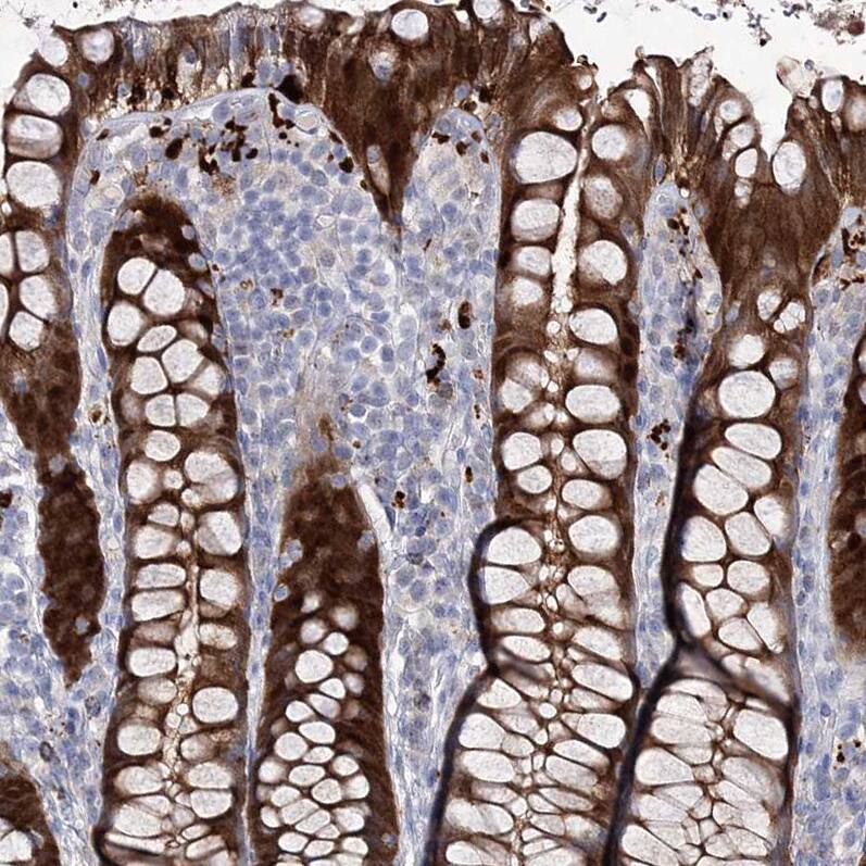 UDP glucose dehydrogenase Antibody - BSA Free Immunohistochemistry: UDP glucose dehydrogenase Antibody - BSA Free [NBP1-90997]
