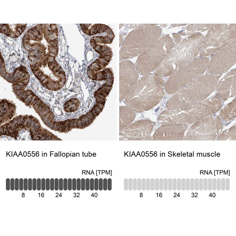 KIAA0556 Antibody - BSA Free Immunohistochemistry: KIAA0556 Antibody - BSA Free [NBP1-91006]