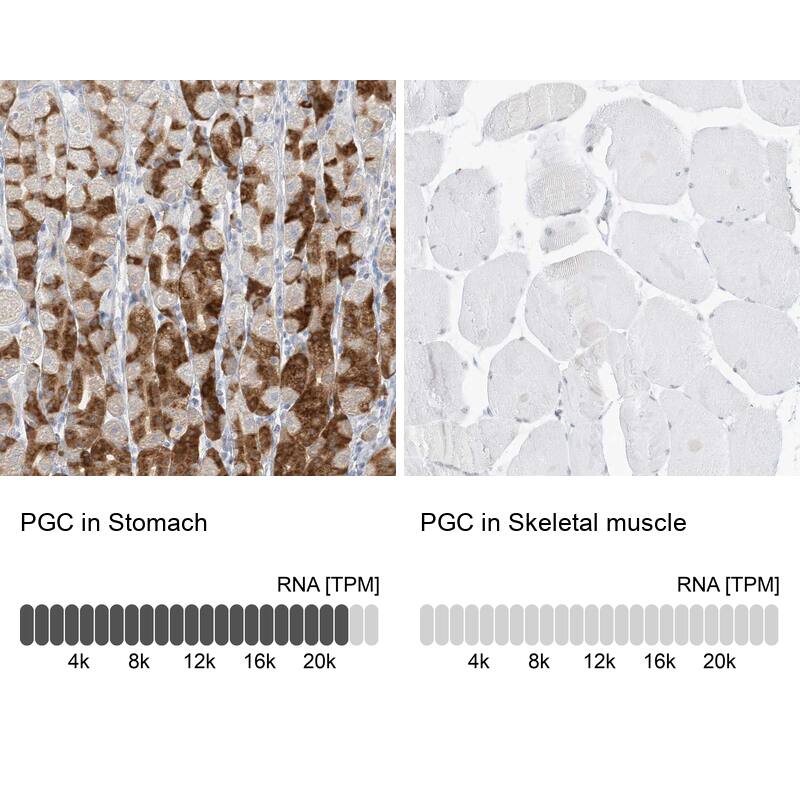 Pepsinogen C/PGC/Progastricsin Antibody - BSA Free Immunohistochemistry-Paraffin: Pepsinogen C/PGC/Progastricsin Antibody [NBP1-91011]