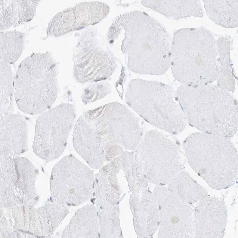 Pepsinogen C/PGC/Progastricsin Antibody - BSA Free Immunohistochemistry-Paraffin: Pepsinogen C/PGC/Progastricsin Antibody [NBP1-91011]