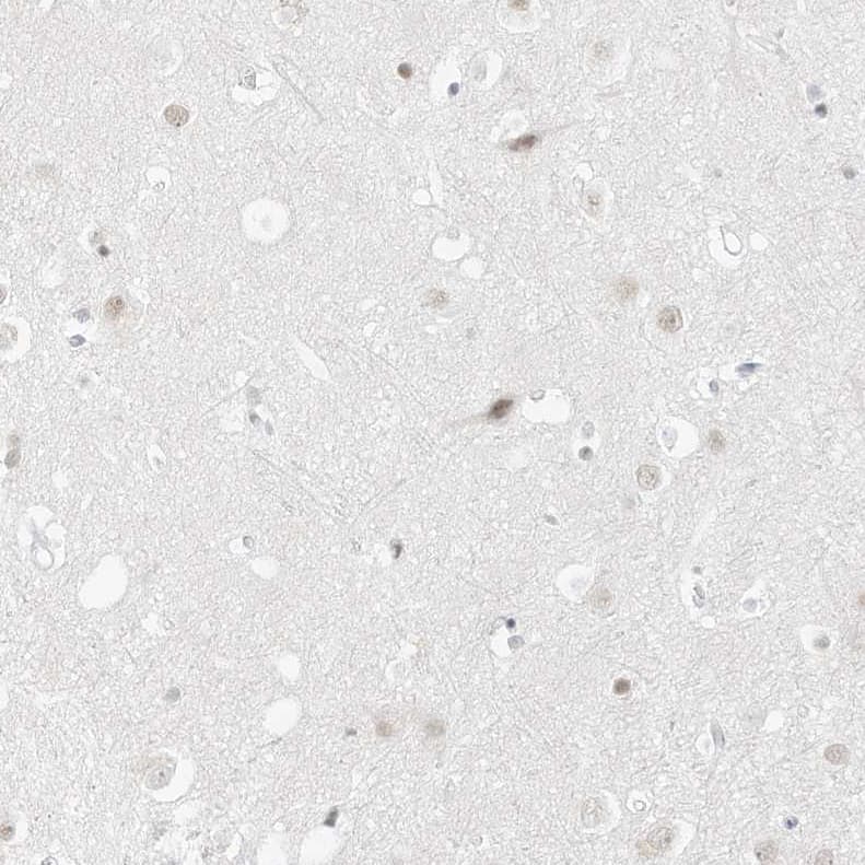 Pepsinogen C/PGC/Progastricsin Antibody - BSA Free Immunohistochemistry-Paraffin: Pepsinogen C/PGC/Progastricsin Antibody [NBP1-91011]