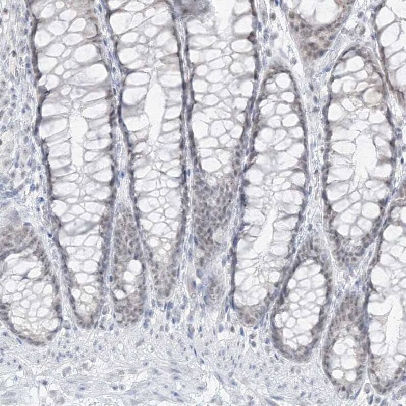 Pepsinogen C/PGC/Progastricsin Antibody - BSA Free Immunohistochemistry-Paraffin: Pepsinogen C/PGC/Progastricsin Antibody [NBP1-91011]