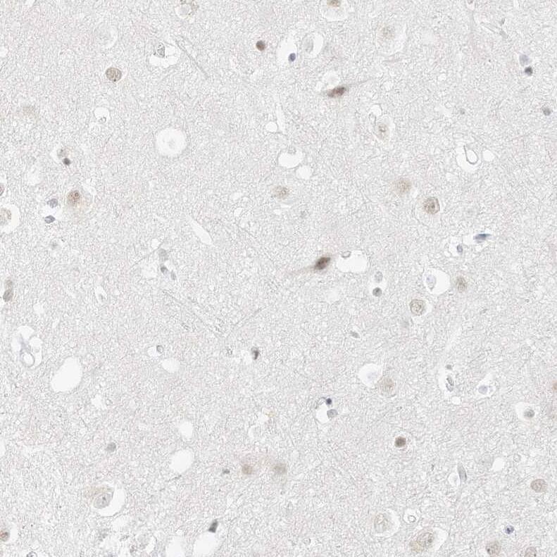 Pepsinogen C/PGC/Progastricsin Antibody - BSA Free Immunohistochemistry: Pepsinogen C/PGC/Progastricsin Antibody - BSA Free [NBP1-91011]