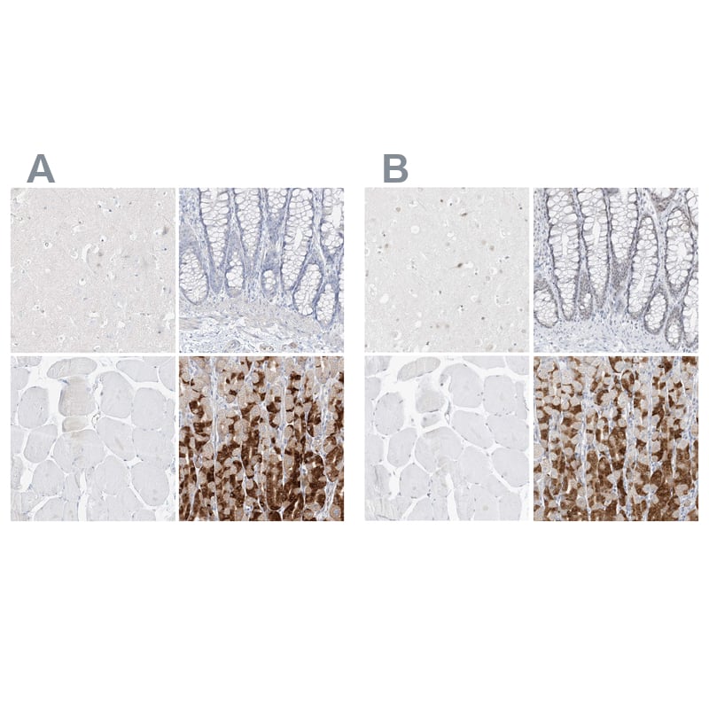Pepsinogen C/PGC/Progastricsin Antibody - BSA Free Immunohistochemistry-Paraffin: Pepsinogen C/PGC/Progastricsin Antibody [NBP1-91012]