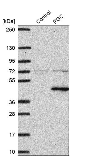 Pepsinogen C/PGC/Progastricsin Antibody - BSA Free Western Blot: Pepsinogen C/PGC/Progastricsin Antibody - BSA Free [NBP1-91012]