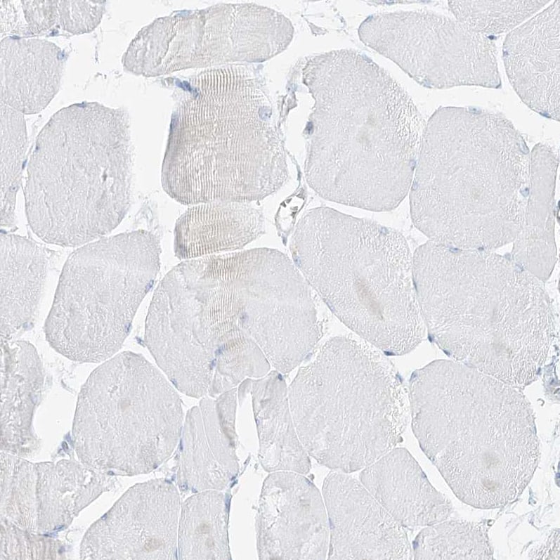 Pepsinogen C/PGC/Progastricsin Antibody - BSA Free Immunohistochemistry: Pepsinogen C/PGC/Progastricsin Antibody - BSA Free [NBP1-91012]