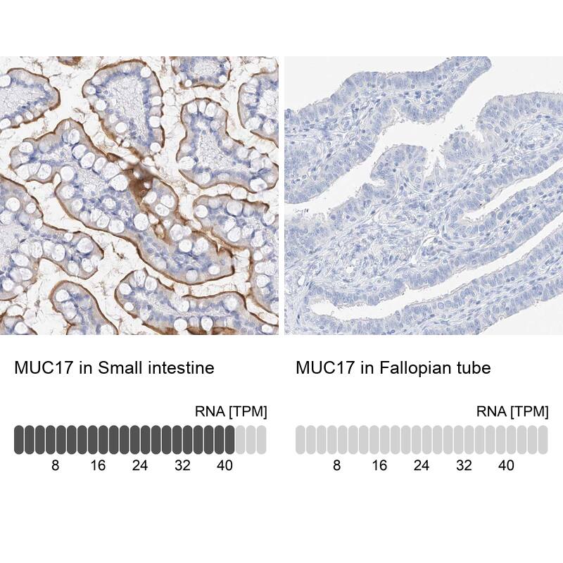 MUC17 Antibody - BSA Free Immunohistochemistry: MUC17 Antibody - BSA Free [NBP1-91013]
