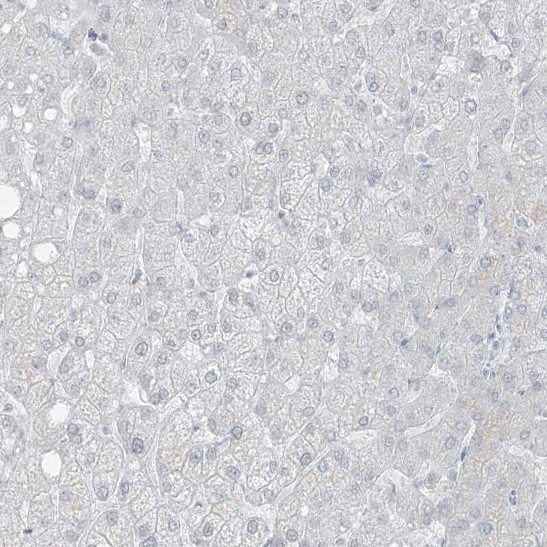 PRDM6 Antibody - BSA Free Immunohistochemistry: PRDM6 Antibody - BSA Free [NBP1-91022]