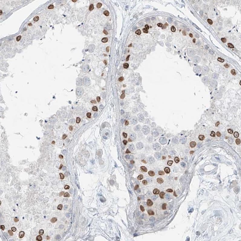 PRDM6 Antibody - BSA Free Immunohistochemistry: PRDM6 Antibody - BSA Free [NBP1-91022]
