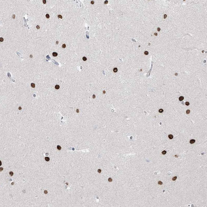 PRDM6 Antibody - BSA Free Immunohistochemistry: PRDM6 Antibody - BSA Free [NBP1-91022]