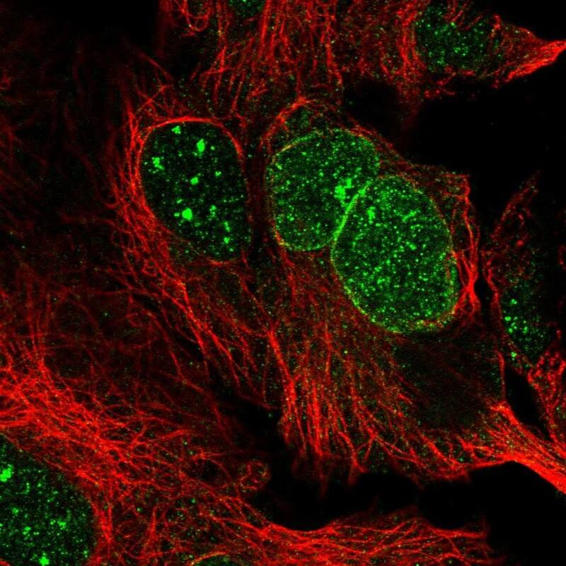 RANBP17 Antibody - BSA Free Immunocytochemistry/ Immunofluorescence: RANBP17 Antibody - BSA Free [NBP1-91029]