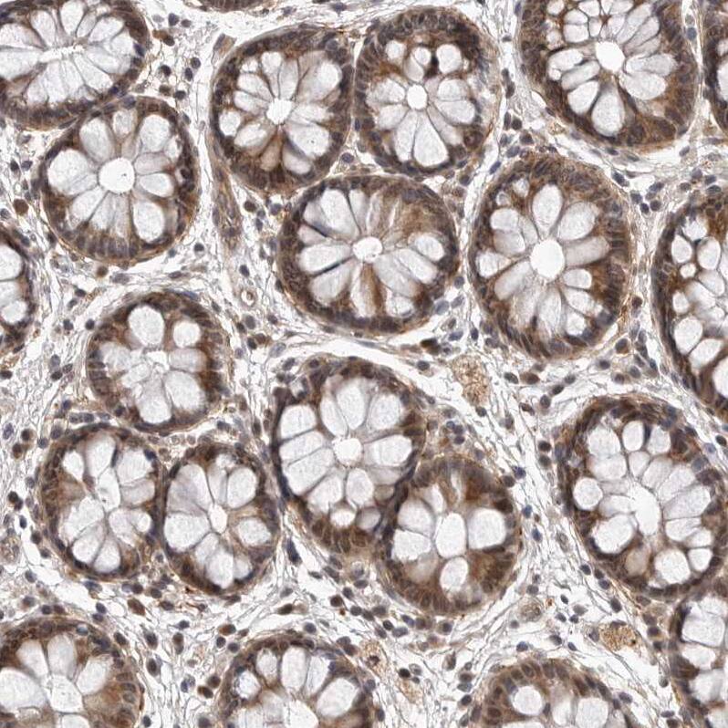 KIAA1614 Antibody - BSA Free Immunohistochemistry: KIAA1614 Antibody - BSA Free [NBP1-91038]